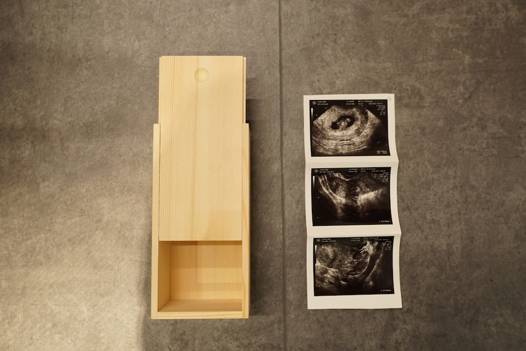 左邊是Angle媽為女兒訂做的小木盒，右邊是女兒的超聲波照片。生與死，只差一線。