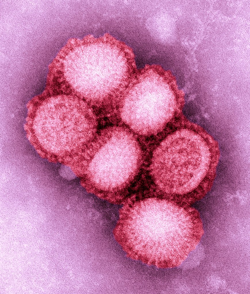 甲型H1N1流感病毒（豬流感病毒）