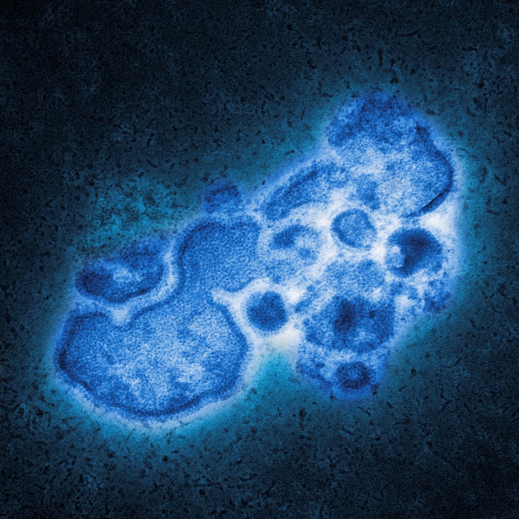 高致病性禽流感病毒（H7N9）