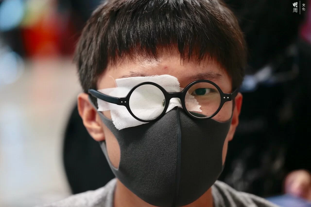 812_airport_eyeforeye_019