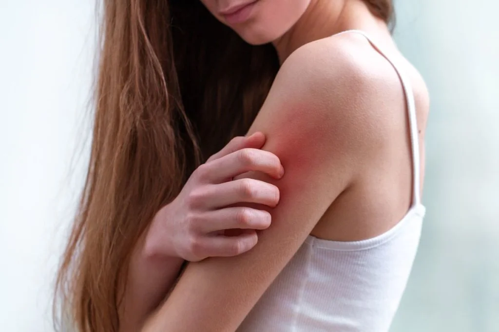 young-woman-suffering-from-itching-her-skin-scratching-itchy-place_low