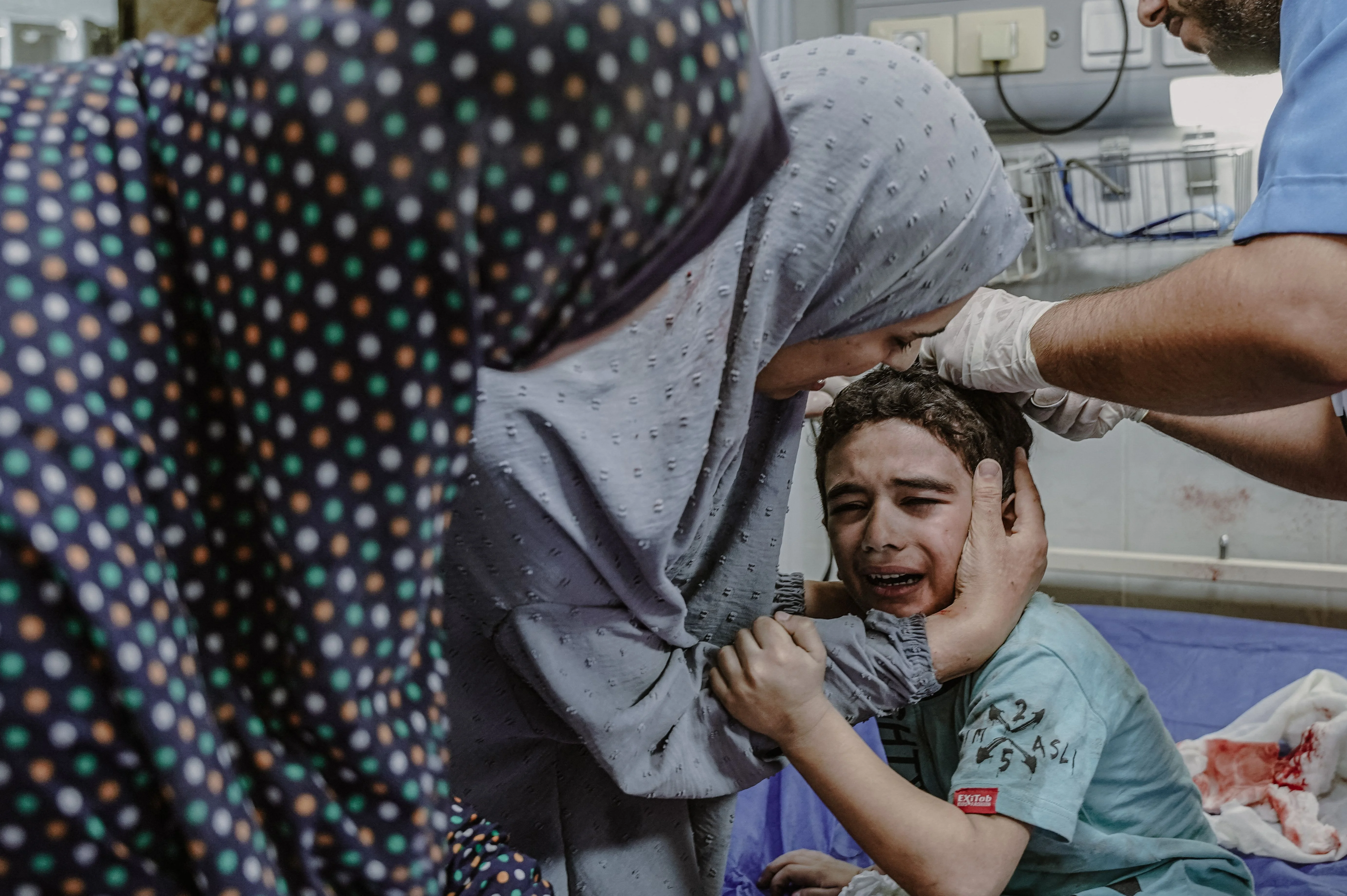 在以色列轟炸加沙期間，一名巴勒斯坦兒童受傷。（法新社圖片）