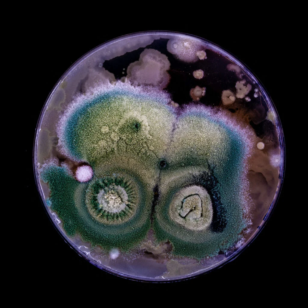 Bacteria and fungi cultured on Petri dish. (Photo by WLADIMIR BULGAR/SCIENCE PHOTO LI / WBU / Science Photo Library via AFP)