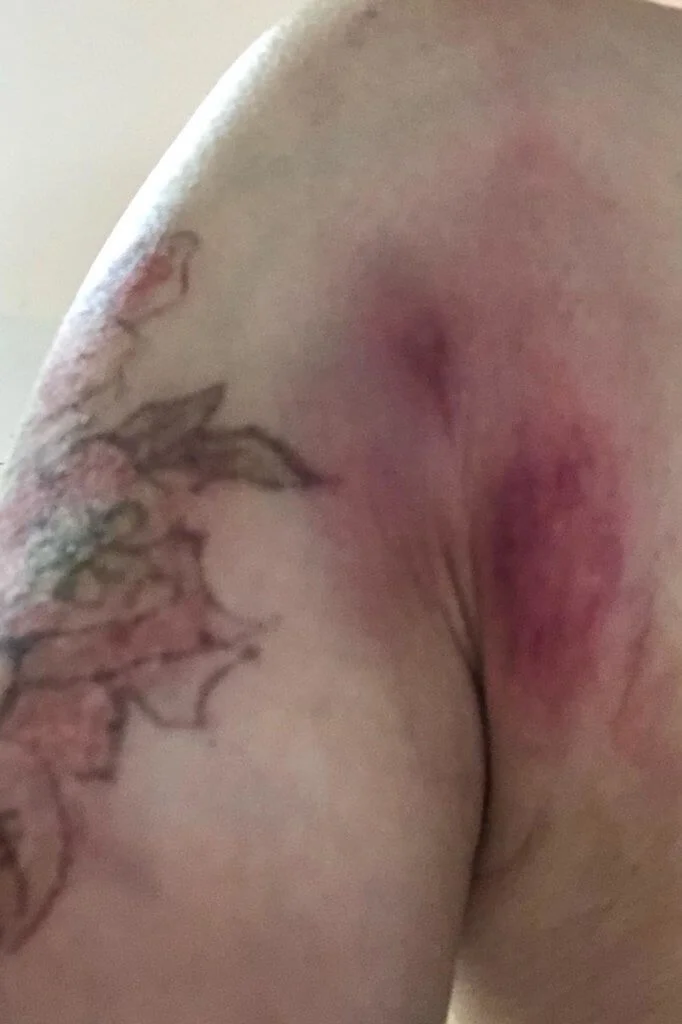 拍打戲打至周身瘀傷，令她明白做打女的辛酸。