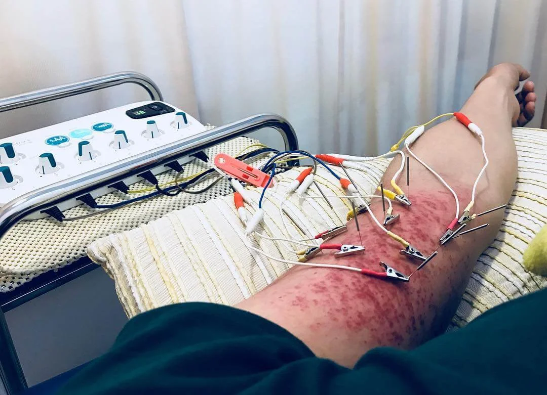 有「地獄黑仔王」之稱的他，經常受傷，需接受治療。