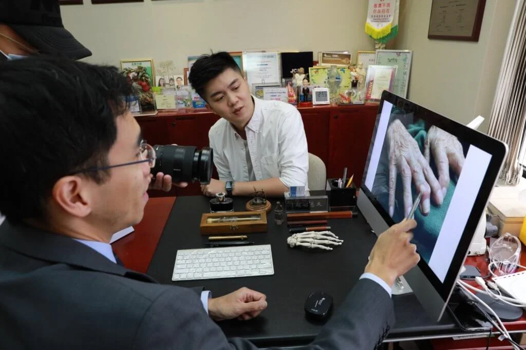 痛風患者結晶積聚在關節位，嚴重者令手指或腳趾變形。