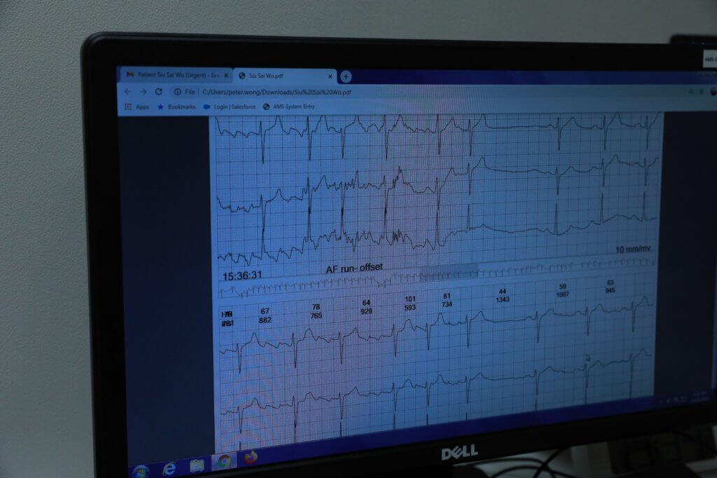 心電圖多用於檢查冠心病或心律病