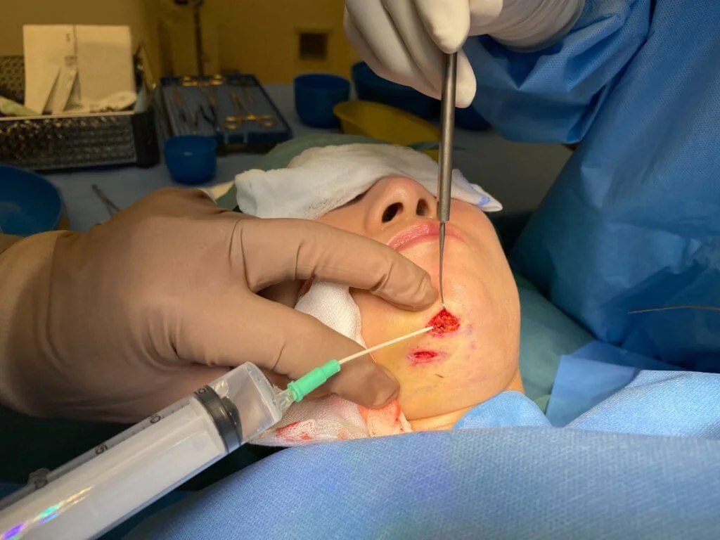 劉晨芝現時每天要護理傷口，希望法律可為她討回公道。