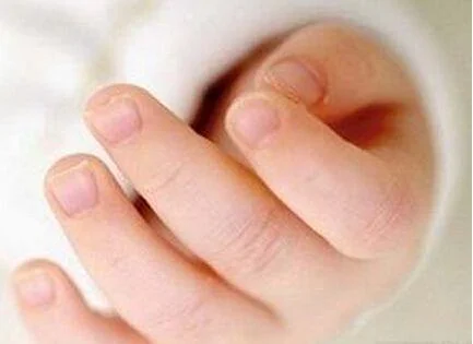 小朋友很容易被自己的指甲划傷