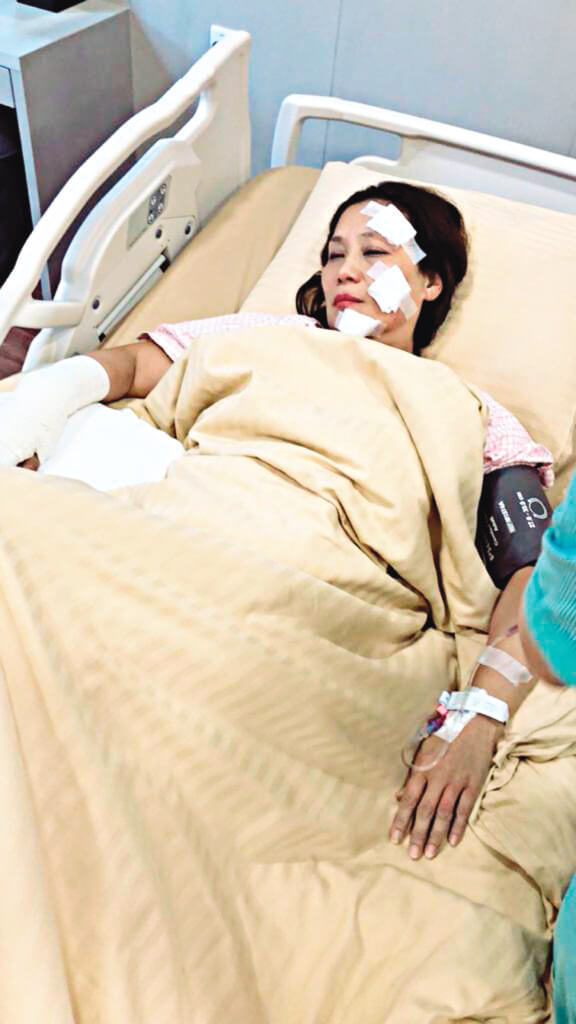 楊盼盼一八年在馬來西亞拍電影《大地回春》，拍攝現場發生意外起火，她亦被送往當地醫院做手術。