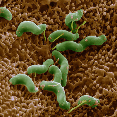 人類的胃部是幽門螺旋桿菌的溫床