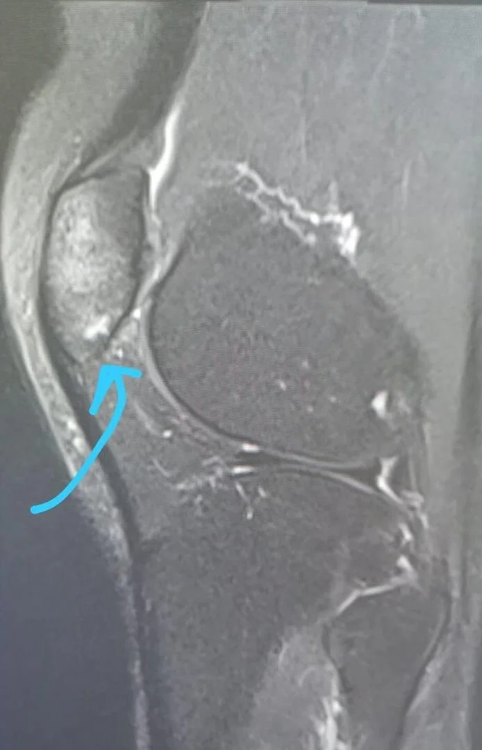 203891815_313718323734215_327368247179431844_n