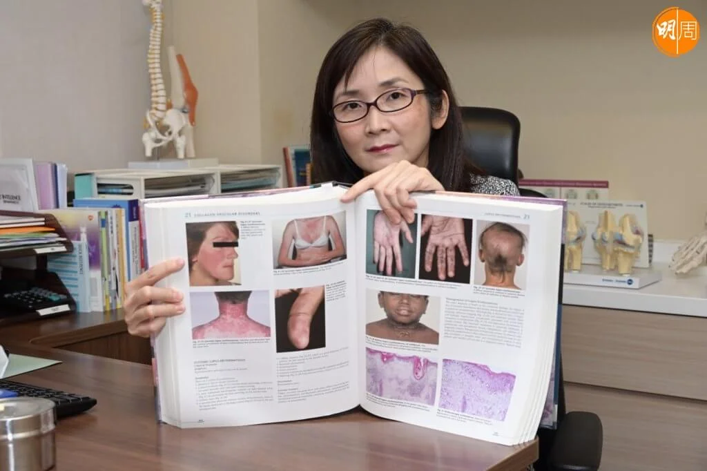 周醫生表示紅斑狼瘡症的複雜之處，是患者往往有不同的病徵，要透過抽血檢測逐一排查。