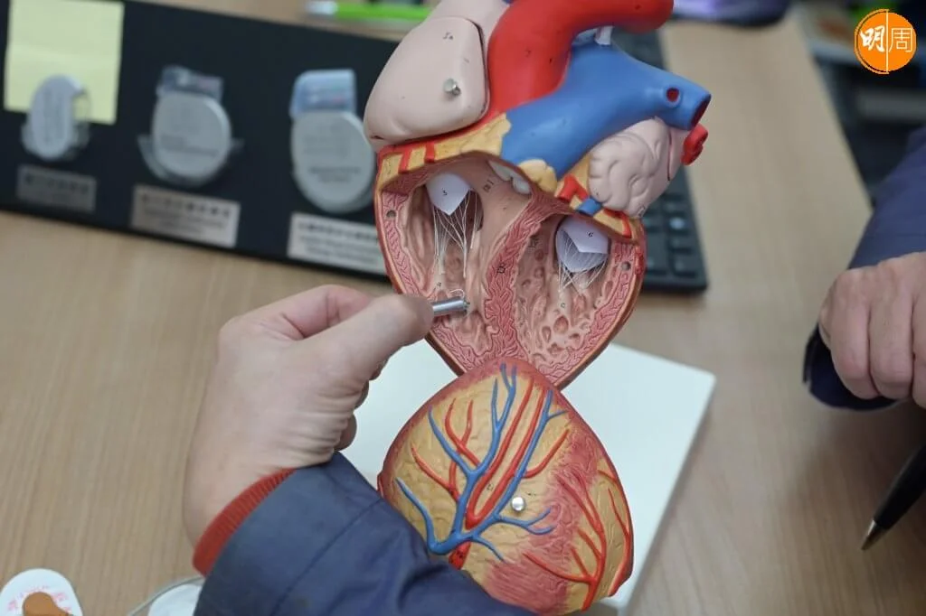 心臟跳動代表了生命力，不過現時心血管疾病，已經成為全球最常見的死因。