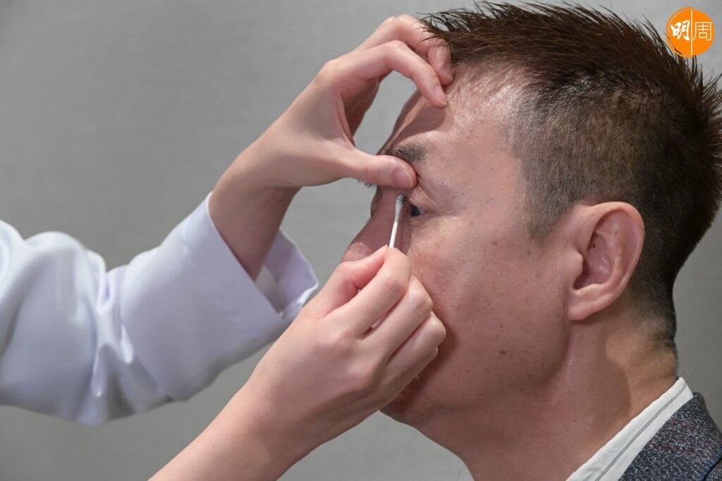 清潔眼皮能預防瞼板腺功能障礙 