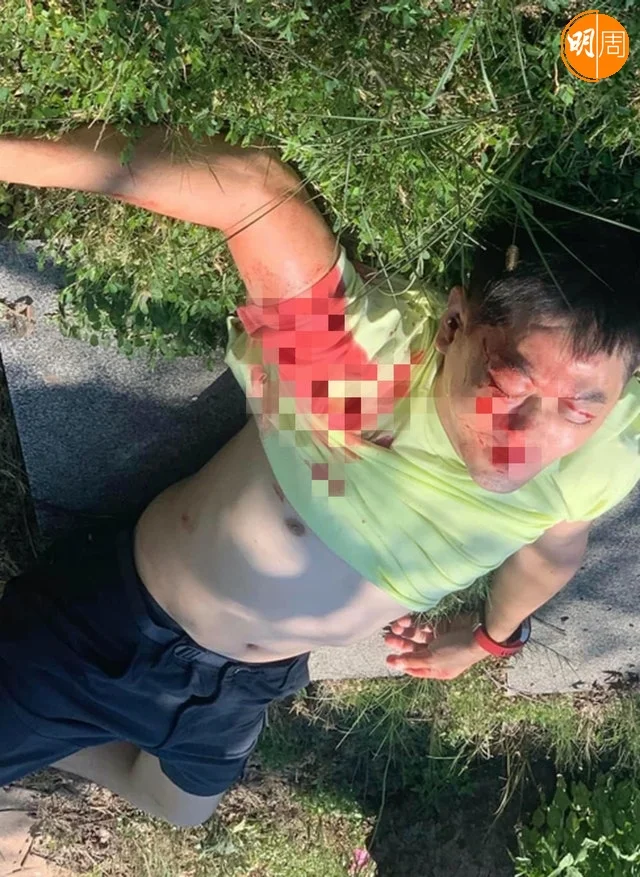 網上流出傷者血流披面照,經理人已否認這位傷者是林志穎。