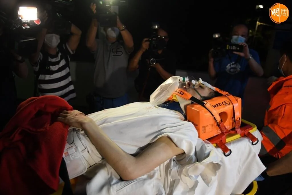 阿MO受傷後即送院救治，現仍留醫ICU。