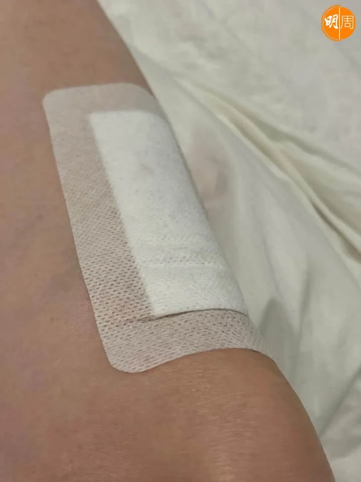 留下兩吋長傷口