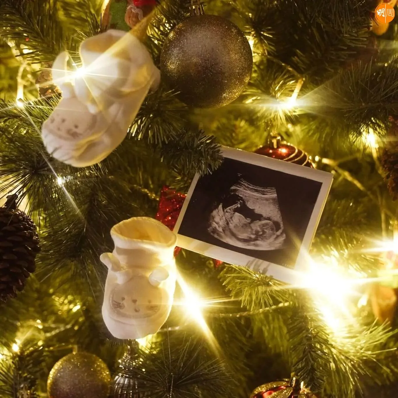 胎兒的超聲波照。