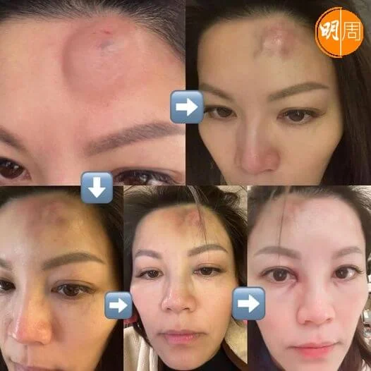 康子妮為大家直擊痊癒過程。