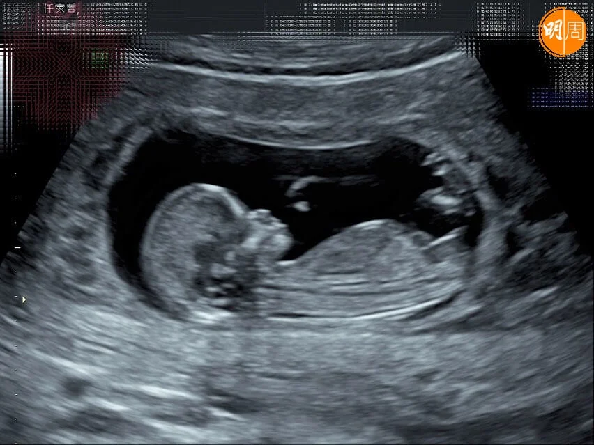 Selina產檢時聽到胎兒心跳聲，感動得與小徐一同落淚。