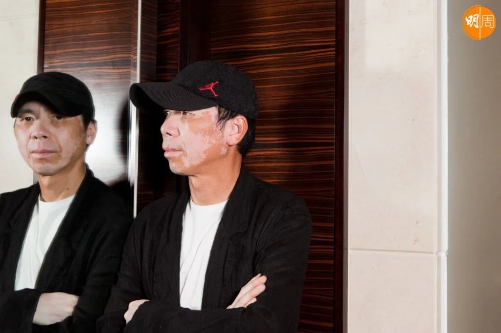 著名導演馮小剛年輕時已經開始發病