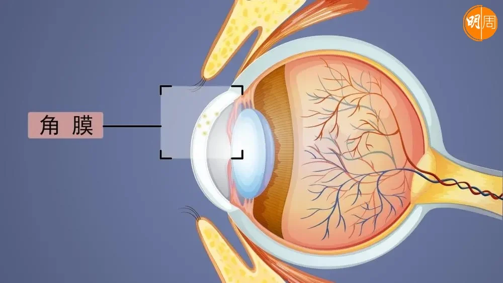 角膜在眼睛最前方，一旦受損有機會影響視力