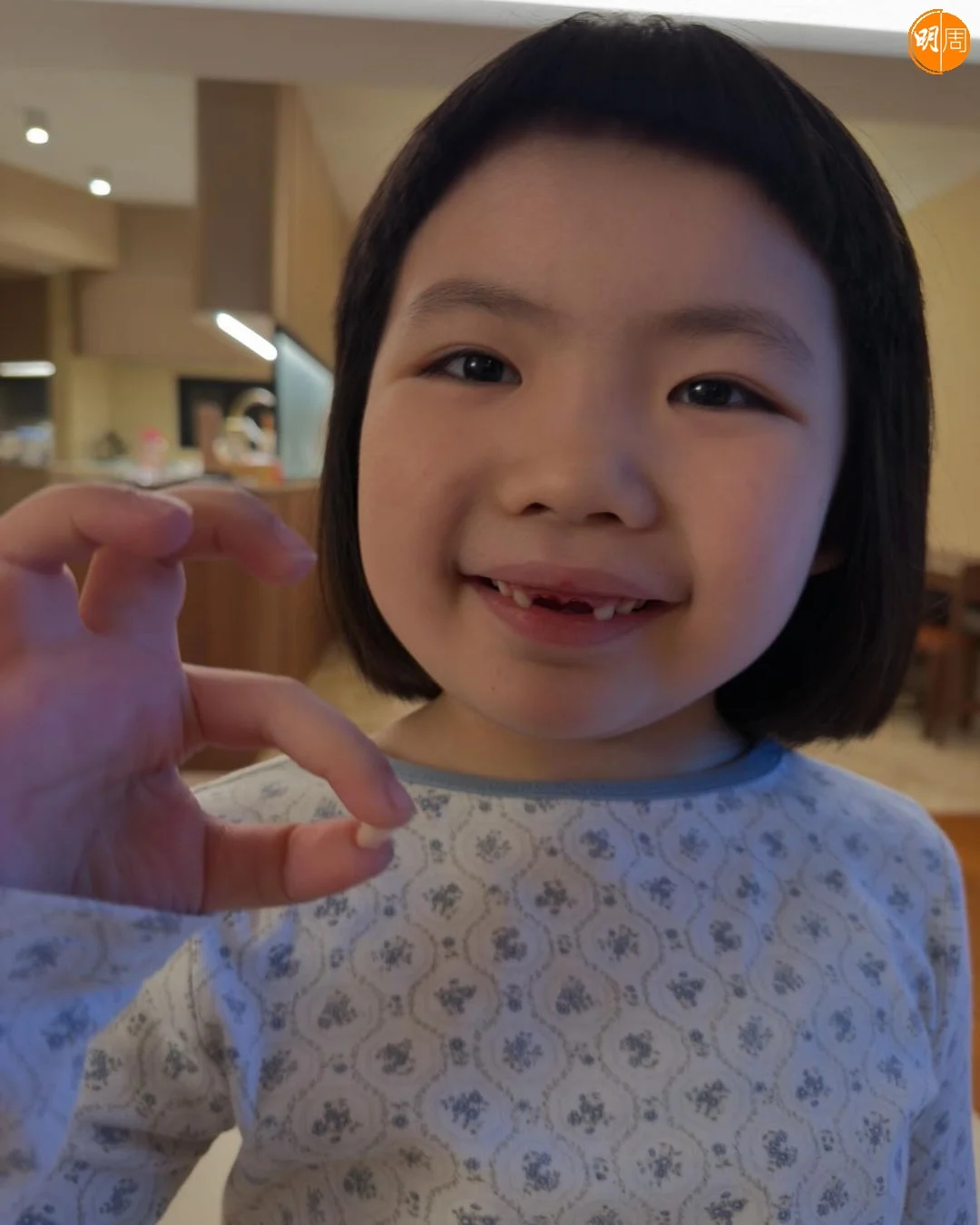 李璨琛話這是他剝嘅第四隻牙。