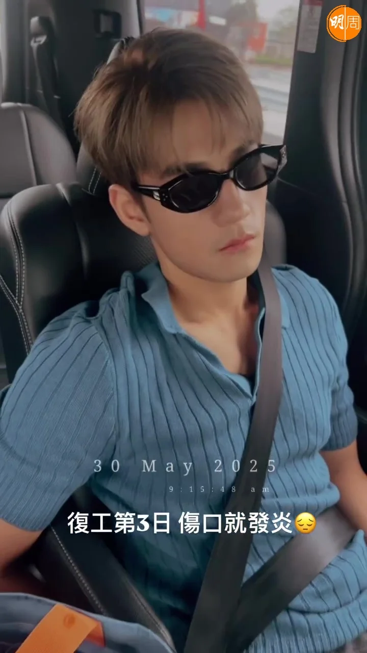 Jeffrey復工3日就傷口發炎。