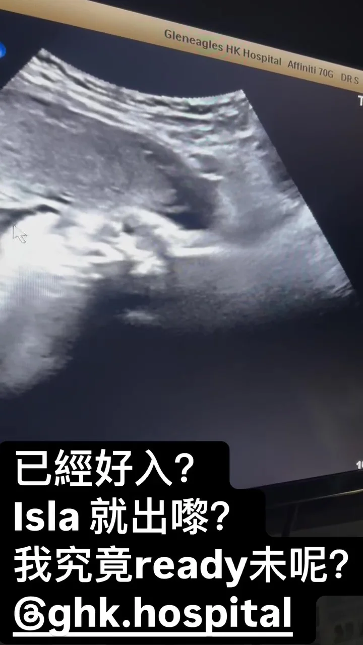 醫生話BB想出來了。